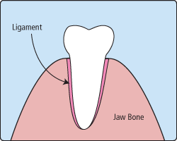 tooth extraction diagram